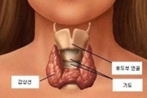 갑상선클리닉