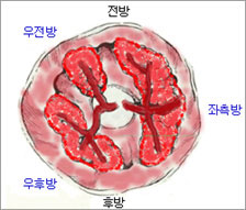 치핵